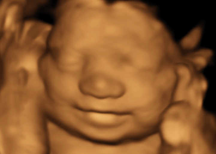 3D-Ultrasound-Baby-Smiling-3D-Baby-Bump